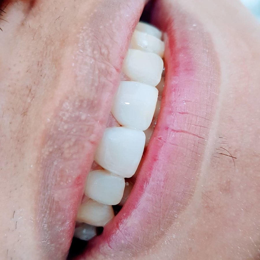 Smile Care Dental Clinic - Smile Care Dental Clinic